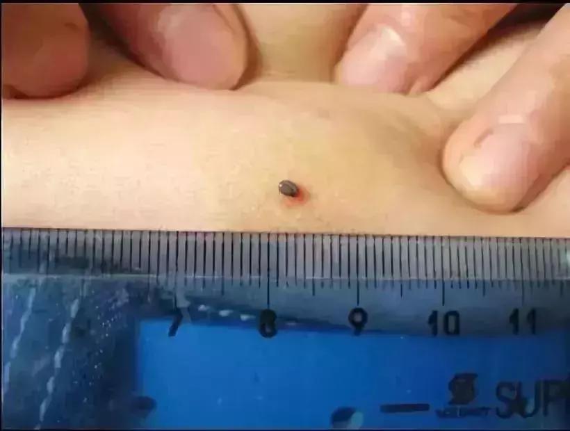 小明快樂疫情日志，最新疫情發(fā)布與日常觀察